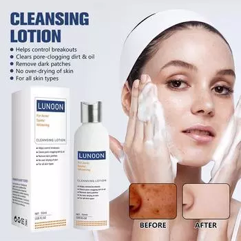 Whitening Freckle Removing Facial Cleanser Fade Dark Anti-Acne Face Spots Skin Cleansing Bright O9J3 white-50ml