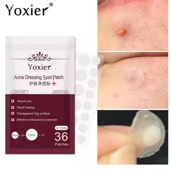 Yoxier 36 шт., патчи для ухода за кожей Ance, водостойкие наклейки для лечения Ance, маска для лица, инструмент для удаления пятен, крем для лица