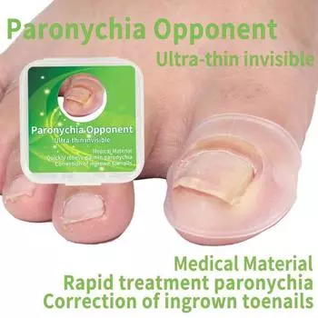 Здоровые подушечки для ногтей на ногах Эластичные ортогнатические силиконовые подушечки для коррекции ногтей 1 Pair