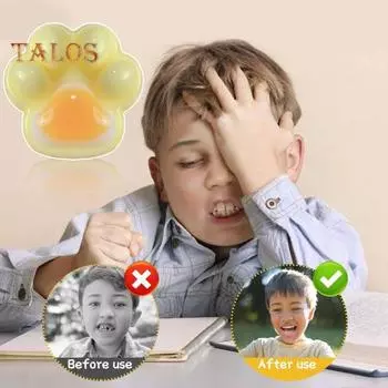 Желтая игрушка-лапка для снятия стресса, сенсорная игрушка для кошек, ущипок в виде лапки, для детей, подростков и взрослых, мягкая игрушка-антистресс из термопластичной резины, игрушка-лапка для животных жёлтый