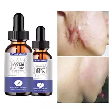 Женский отбеливающий крем для лица, крем для темной кожи, пятна, шрамы, дневной ночной крем для лица, отбеливающий кожу, корейские средства по уходу за кожей 5ml