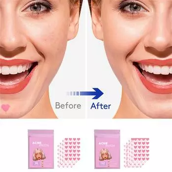 Звездное сердце Прозрачный невидимый пластырь от прыщей Мягкий не раздражающий Устраняет прыщи Закрытый рот Улучшает акне Мышцы гидроколлоидные 192PC розовый