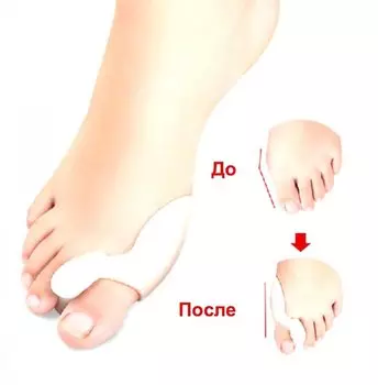 Межпальцевый фиксатор Gelix (GESS-008)