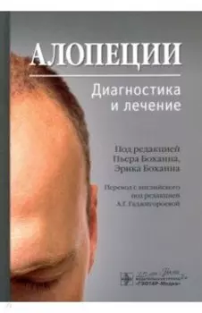 Алопеции. Диагностика и лечение