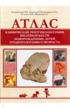 Атлас клинической рентгеноанатомии височной кости новорожденных, детей грудного и раннего возраста