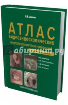 Атлас видеоэндоскопических внутрипросветных операций в клинической онкологии