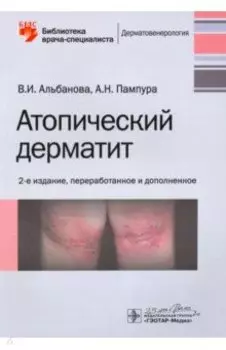 Атопический дерматит