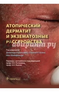 Атопический дерматит и экзематозные расстройства