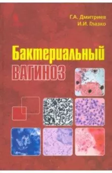 Бактериальный вагиноз