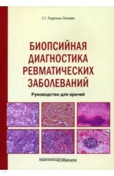Биопсийная диагностика ревматических заболеваний. Руководство для врачей