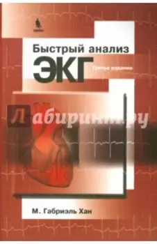 Быстрый анализ ЭКГ