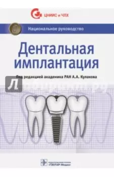 Дентальная имплантация. Национальное руководство