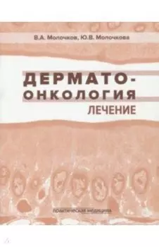Дерматоонкология. Лечение