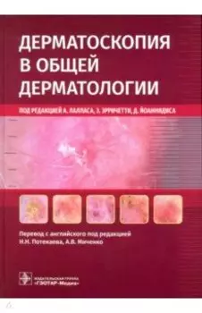 Дерматоскопия в общей дерматологии