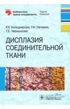 Дисплазия соединительной ткани