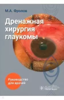 Дренажная хирургия глаукомы