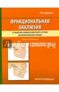 Функциональная окклюзия. От височно-нижнечелюстного сустава до планирования улыбки
