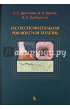 Гастроэзофагеальная рефлюксная болезнь