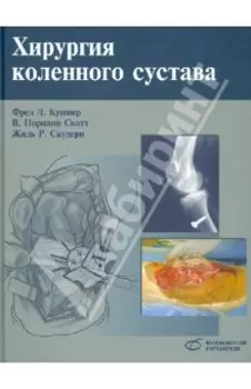 Хирургия коленного сустава