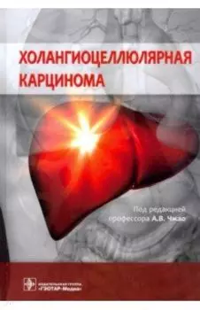 Холангиоцеллюлярная карцинома
