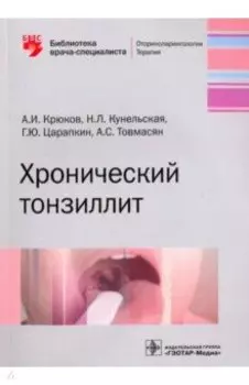 Хронический тонзиллит