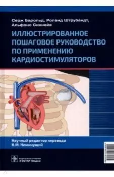 Иллюстрированное пошаговое руководство по применению кардиостимуляторов