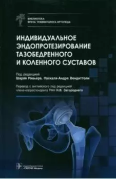 Индивидуальное эндопротезирование тазобедренного и коленного суставов