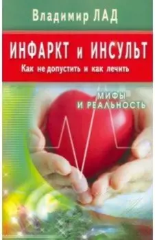 Инфаркт и инсульт. Как не допустить и как лечить. Мифы и реальность