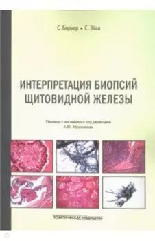 Интерпретация биопсий щитовидной железы