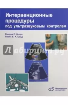 Интервенционные процедуры под ультразвуковым контролем