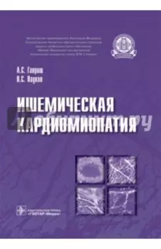 Ишемическая кардиомиопатия