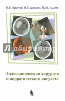 Эндоскопическая хирургия геморрагического инсульта