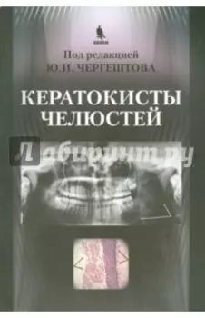 Кератокисты челюстей