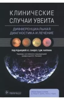 Клинические случаи увеита. Дифференциальная диагностика и лечение