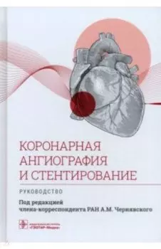 Коронарная ангиография и стентирование. Руководство