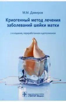 Криогенный метод лечения заболеваний шейки матки