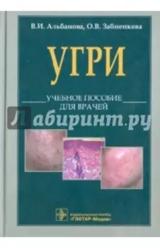 L70. Угри. Учебное пособие для врачей