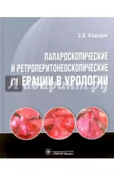 Лапароскопические и ретроперитонеоскопические операции в урологии