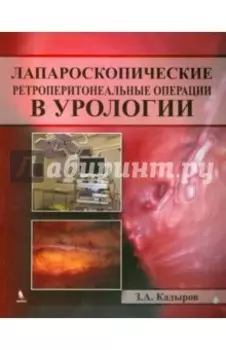 Лапароскопические ретроперитонеальные операции в урологии