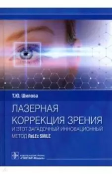 Лазерная коррекция зрения и этот загадочный инновационный метод ReLEx SMILE