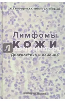 Лимфомы кожи. Диагностика и лечение