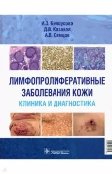 Лимфопролиферативные заболеванания кожи. Клиника и диагностика