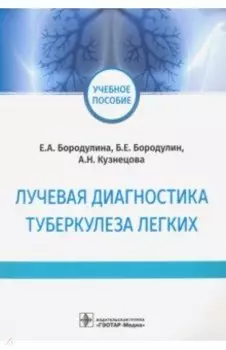 Лучевая диагностика туберкулеза легких. Учебное пособие