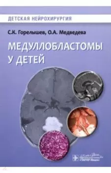 Медуллобластомы у детей. Руководство
