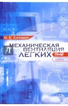 Механическая вентиляция легких