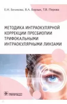 Методика интраокулярной коррекции пресбиопии трифокальными интраокулярными линзами