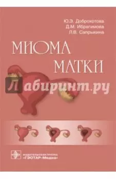 Миома матки. Руководство