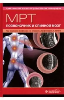 МРТ. Позвоночник и спинной мозг