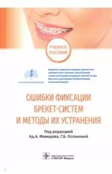 Ошибки фиксации брекет-систем и методы их устранения