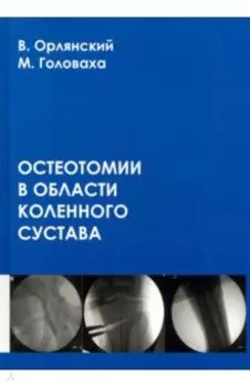Остеотомии в области коленного сустава